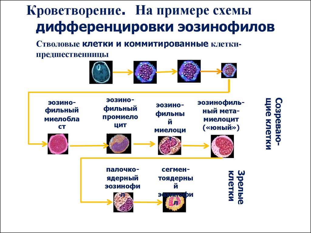 Патогенез лейкозов схема