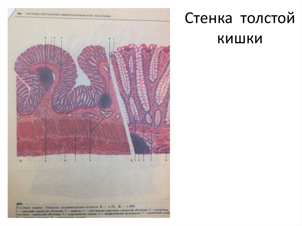 Стенка толстой. Стенка толстой кишечника анатомия. Строение стенки толстой кишки схема. Стенка тонкой кишки схема. Слои стенки Толстого кишечника.