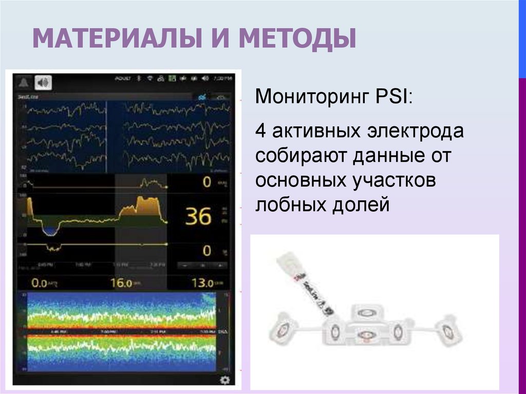 Мониторинг алгоритм. Интраоперационный мониторинг анестезиология. Интраоперационный дыхательный мониторинг. Графический мониторинг респираторной поддержки. Мониторинг глубины анестезии.