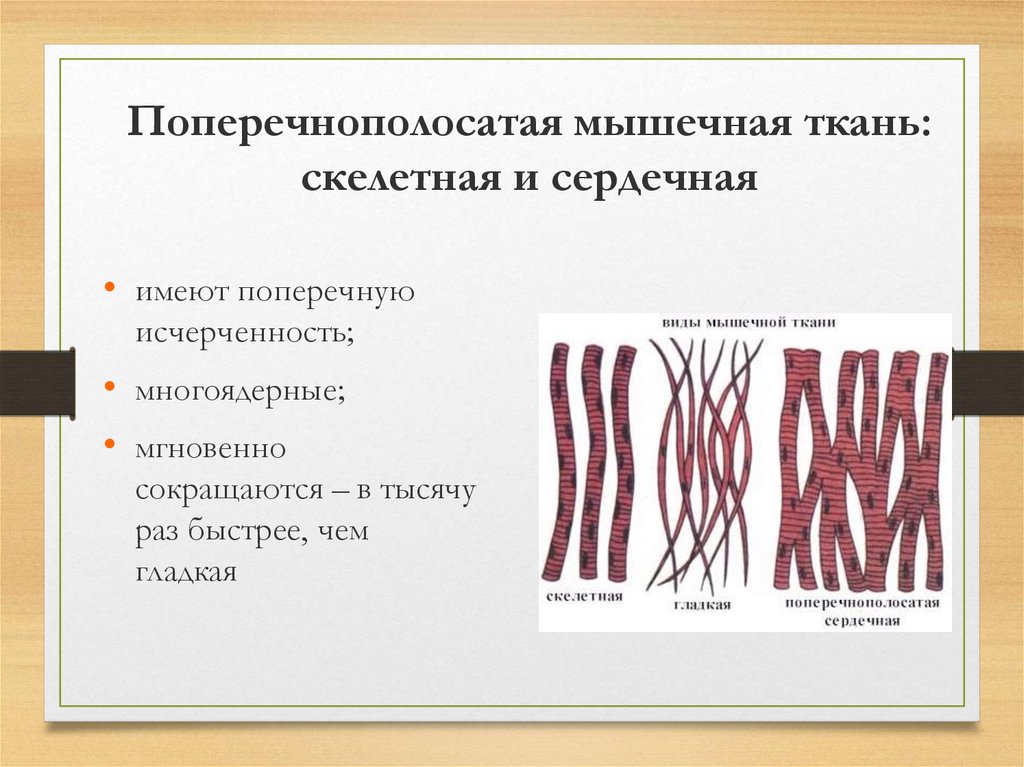 Полосатая мышца. Поперечно-полосатая исчерчение мышечной ткани. Поперечнополосатая сердечная мышца ткани. Поперечно исчерченная Скелетная мышечная ткань. Сердечная мышечная ткань поперечнополосатая мышечная.