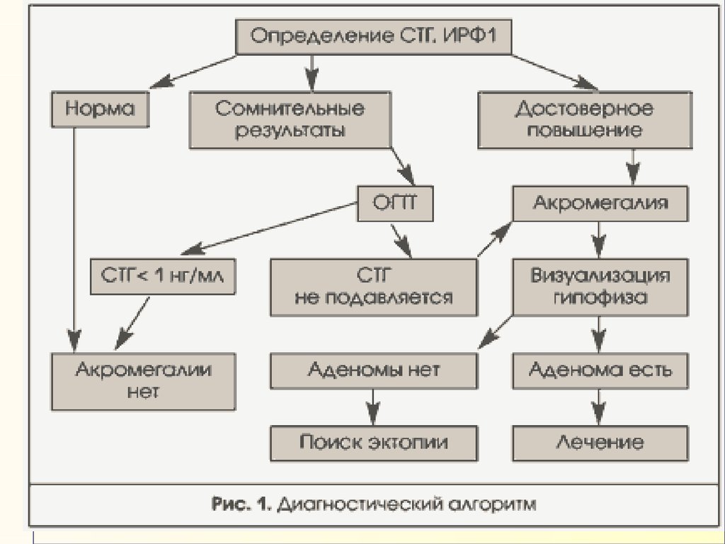 Акромегалия диагностика. Аденома гипофиза дифференциальный диагноз. Акромегалия патологическая анатомия. Акромегалия механизм развития. Диагностический алгоритм акромегалии.