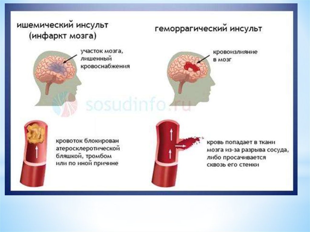 В план сестринской помощи пациенту с циррозом печени м с должна внести