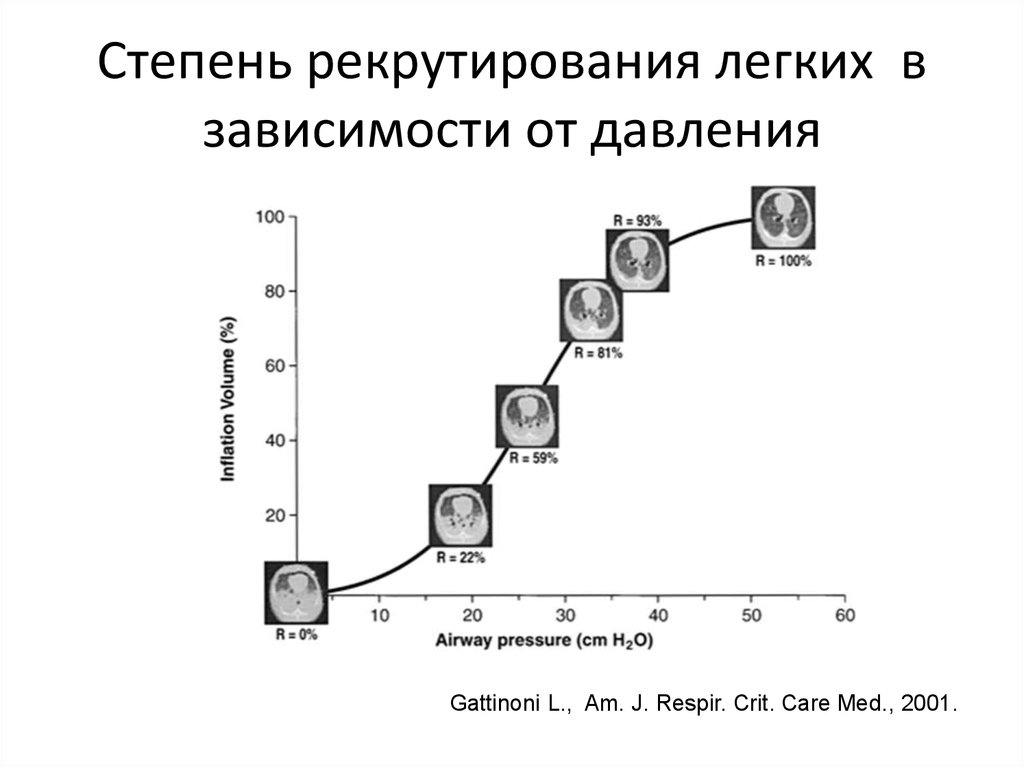 Легкая зависимость. Рекрутирование легких.