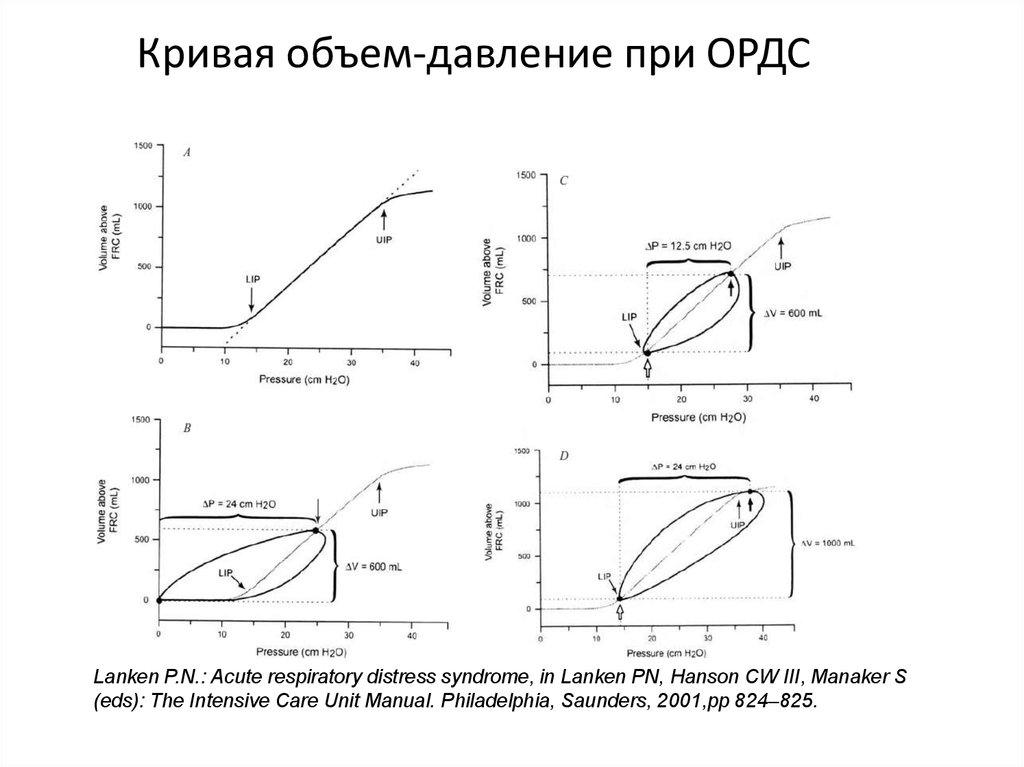 Кривая объема. Диаграмма давление объем. Кривая объем давление для легких физиология. Статическая кривая давление объем. Петля давление объем.