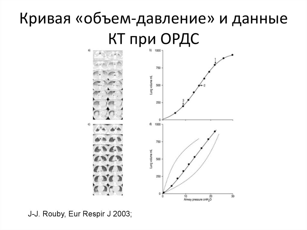 Количество кривой. Статическая кривая давление объем. Кривая объем давление для легких. Кривая «давление-объем» перикардит. Кривая объем давление физиология.