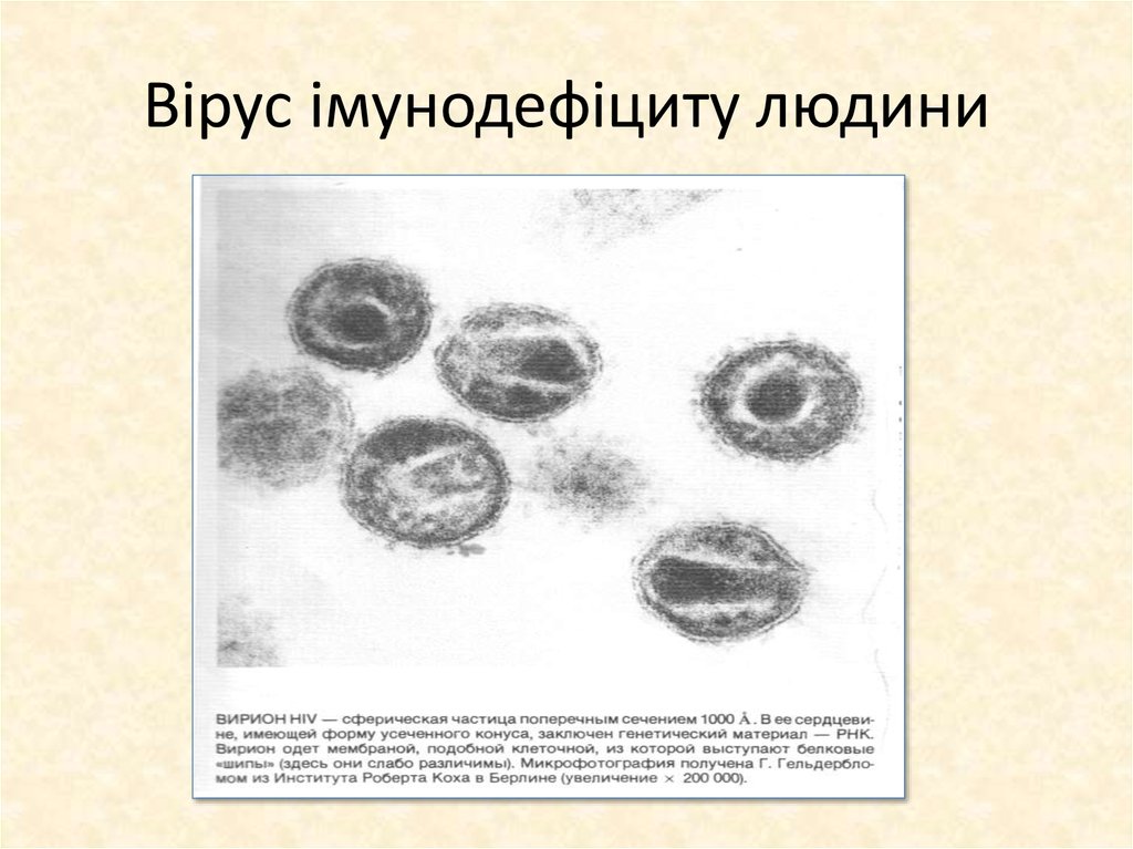 Вірус імунодефіциту людини