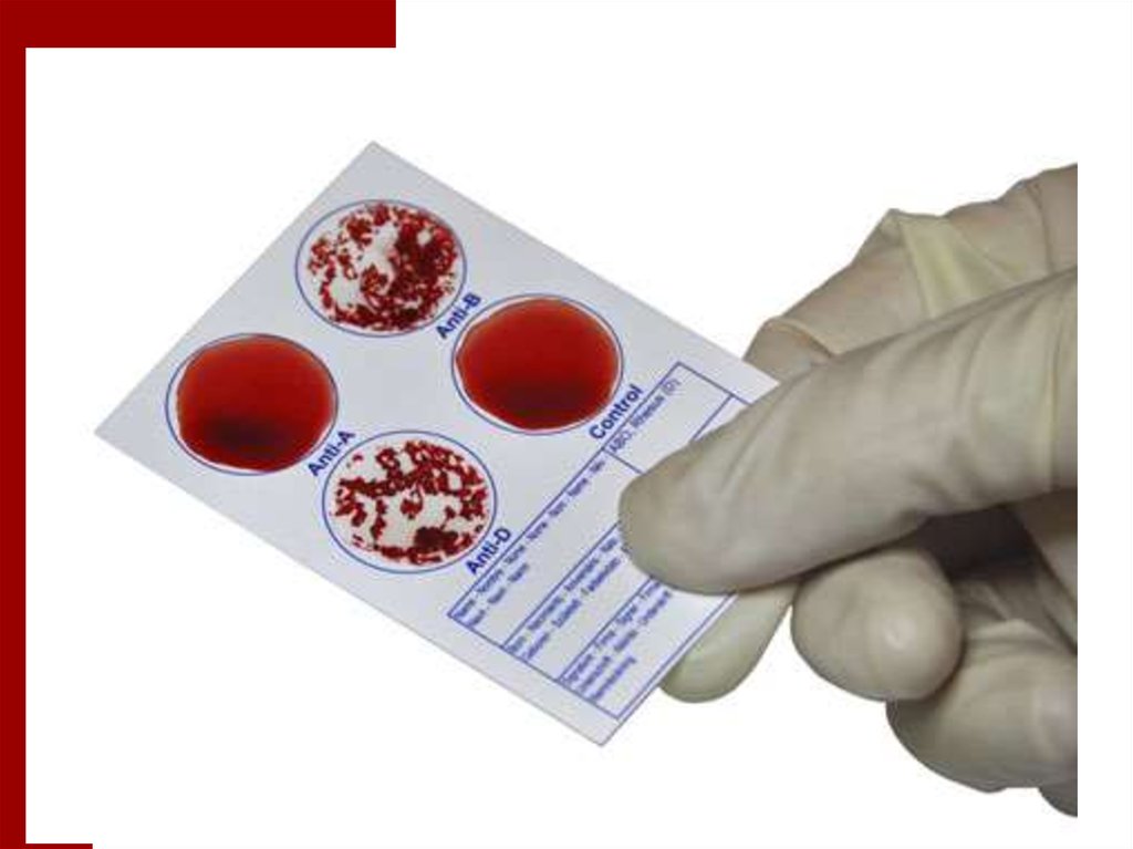 Тест на резус фактор. Экспресс тест на определение группы крови и резус-фактора. Планшетка с определением групп крови и резус фактора. Экспресс тест на группу крови и резус-фактор. Тест на определение группы крови.