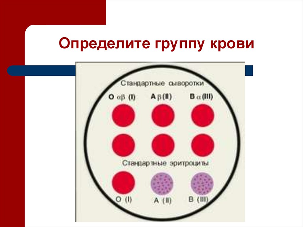 Кровь без резуса. Таблица определения группы крови и резус фактора. Какузнаьь группу крови. Ака определить группу крови. Как узнатьг группу крови.