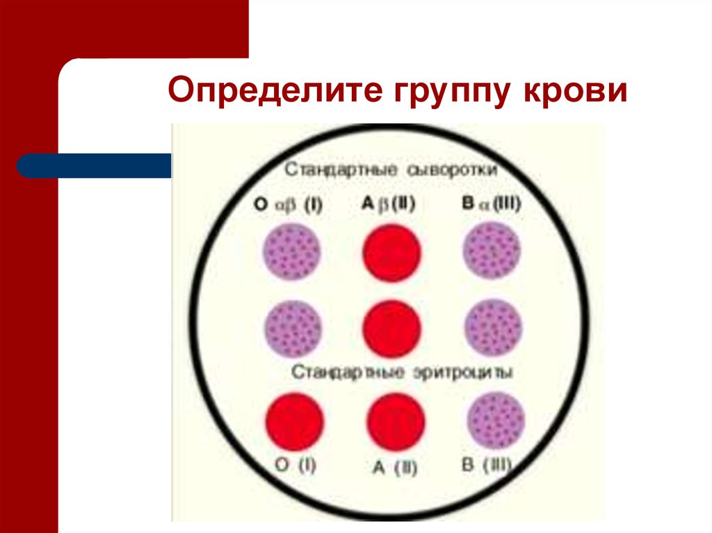 Карточка группы крови. Таблица определения группы крови и резус фактора. Определите резус фактора группы крови человека. Чашка Петри для определения группы крови. Определение группы крови рисунок.