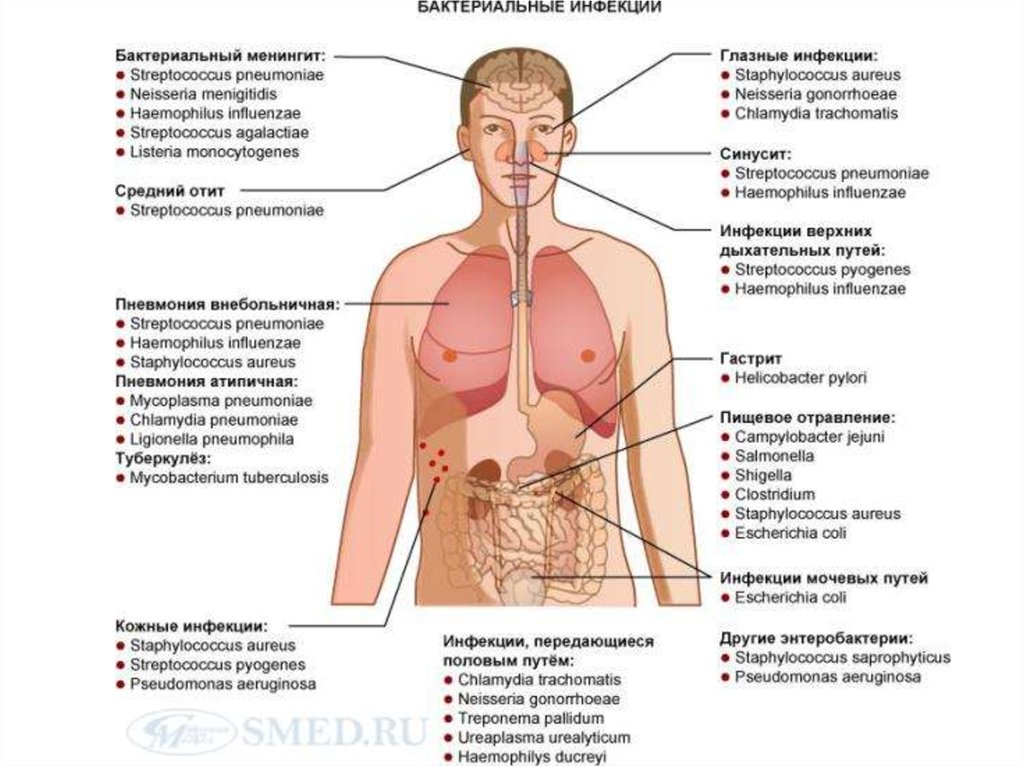 Какие инфекции можно. Бактериальная инфекция симптомы. Бактериальные заболевания симптомы. Бактериальных инфекцияии. Признаки бактериальных заболеваний.