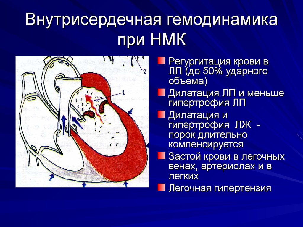 Схема гемодинамики при пороках сердца - 94 фото