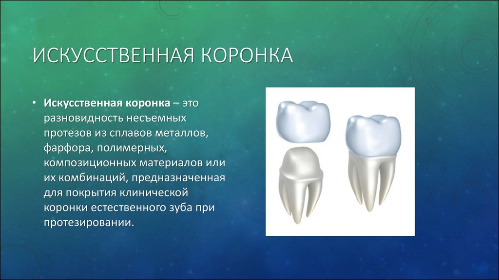 Какую функцию выполняет коронка зуба. Искусственные коронки. Искусственные зубные коронки. Коронки ортопедическая стоматология. Одиночные искусственные коронки.