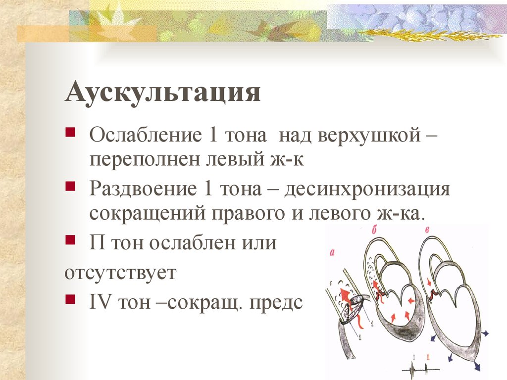 Синдром недостаточности митрального клапана