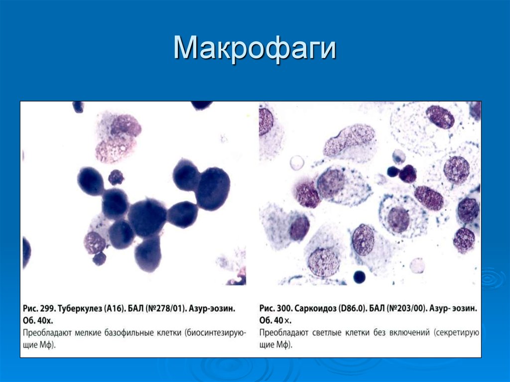 Макрофаги 2 3. Пенистые макрофаги цитология. Макрофаги, гистиоциты фагоцитоз гистология. Макрофаги в крови.