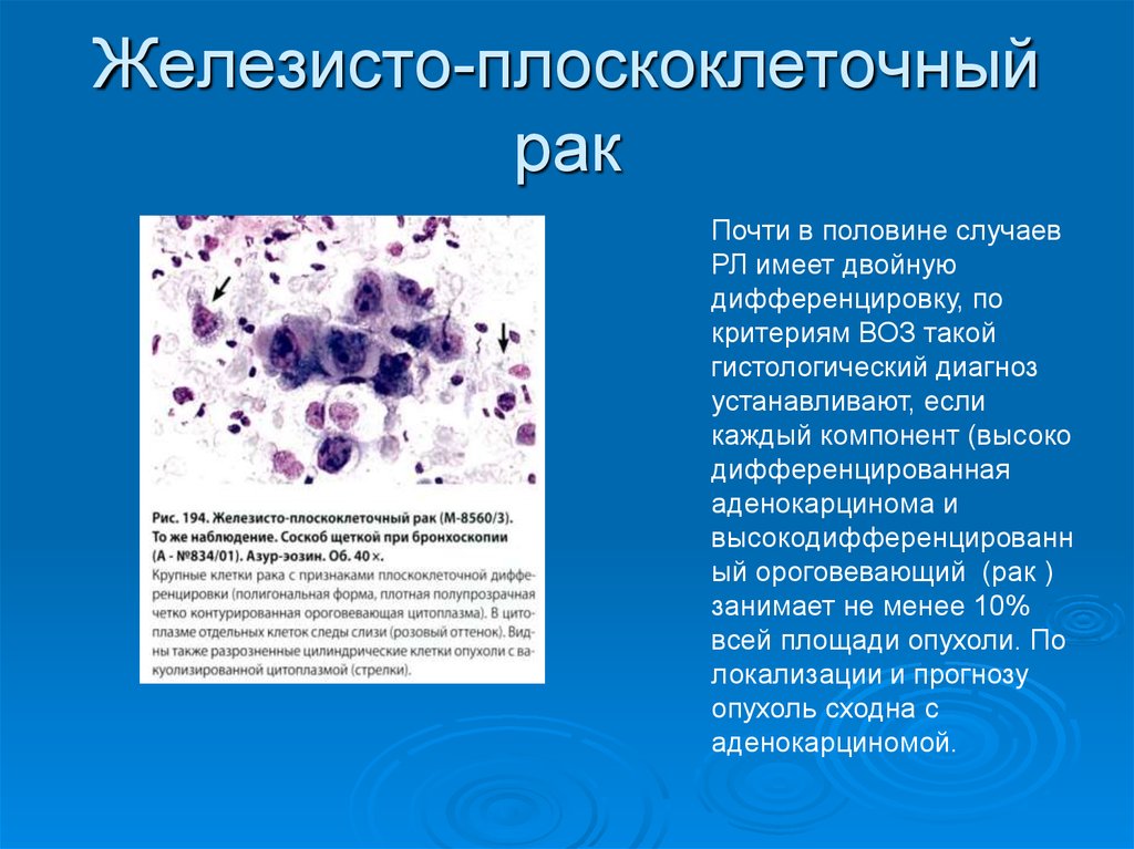 Цитологическая картина реактивных изменений эпителия слизистой оболочки воспалительного типа что это