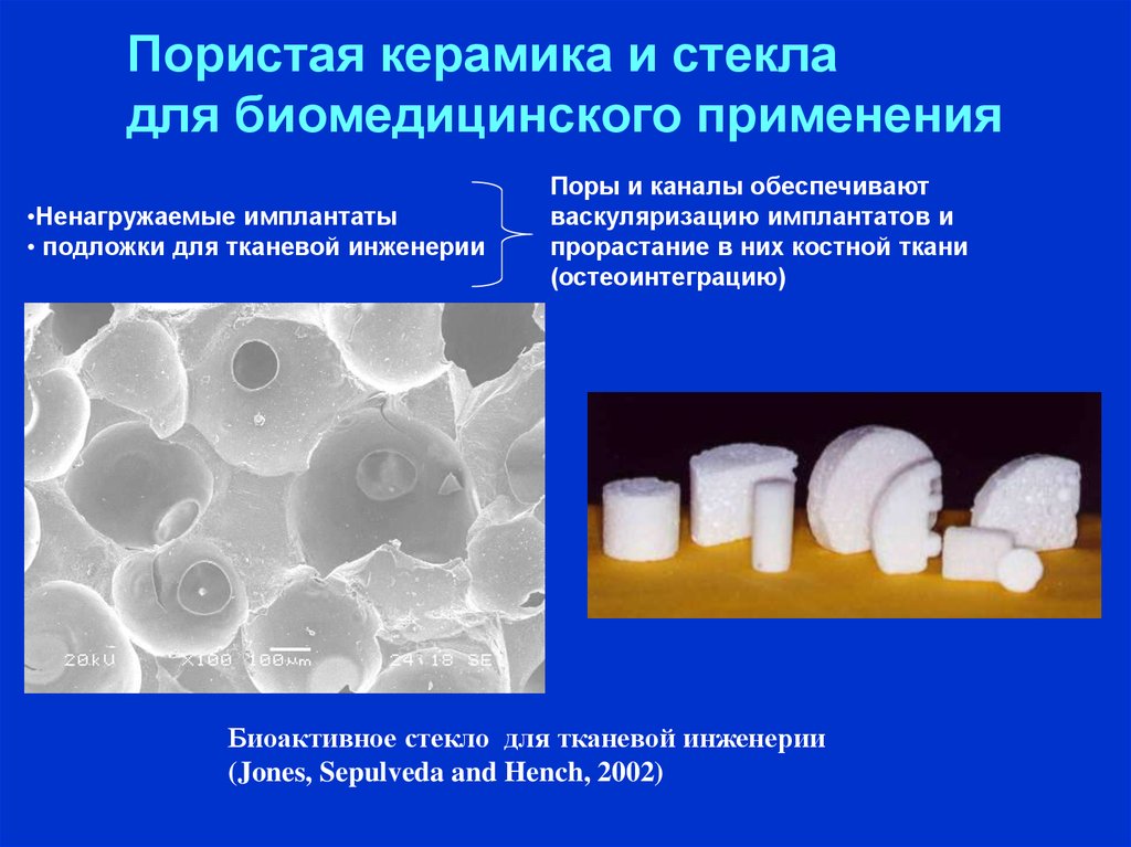 Биоматериал. Биоматериалы в тканевой инженерии. Биоактивная пористая керамика. Биоактивные стекла. Стеклокерамика биоматериалы.
