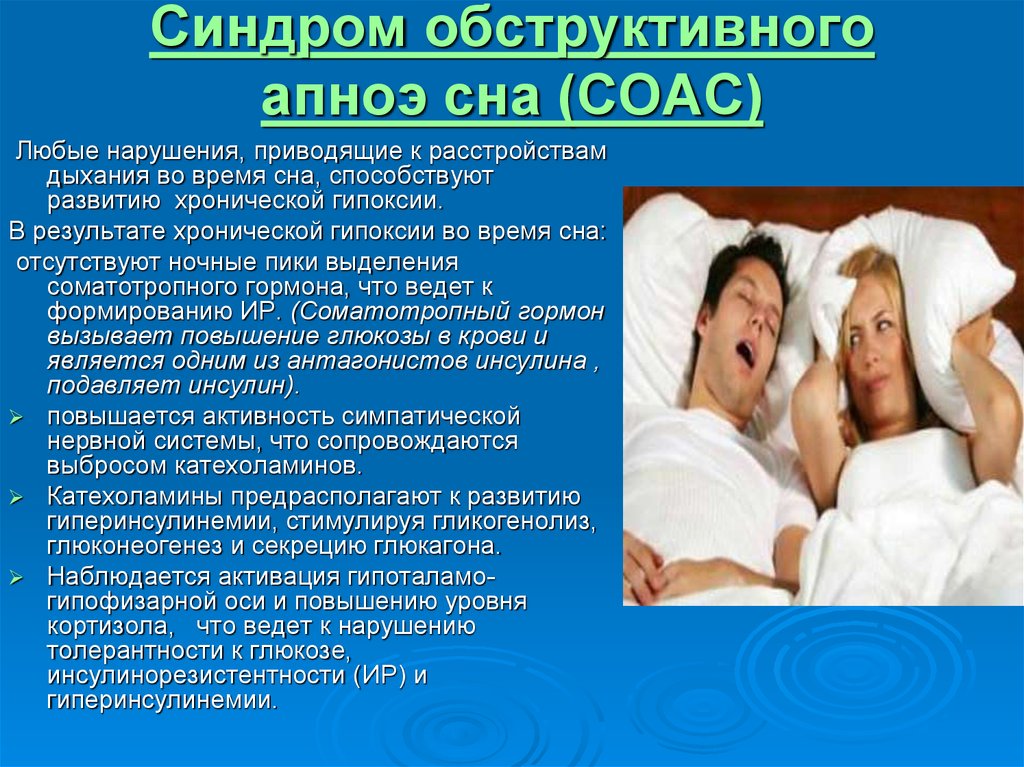 Ночное апноэ лечение. Синдром обструктивного апноэ сна. Синдром обструктивного ап ноя сна. Синдром обструктивного гипопноэ. Синдром апноэ во сне.