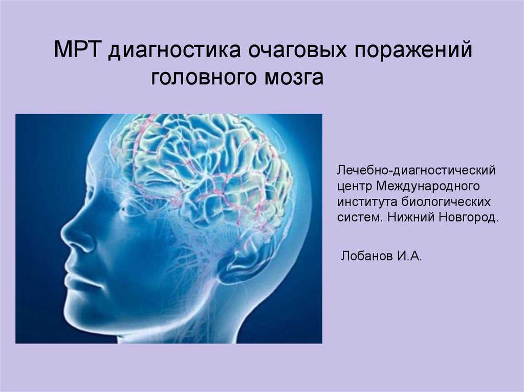 Поражение головного мозга. Очаговое поражение мозга. Осложнения очагового поражения головного мозга. Очаговые поражения головного мозга характеризуются.