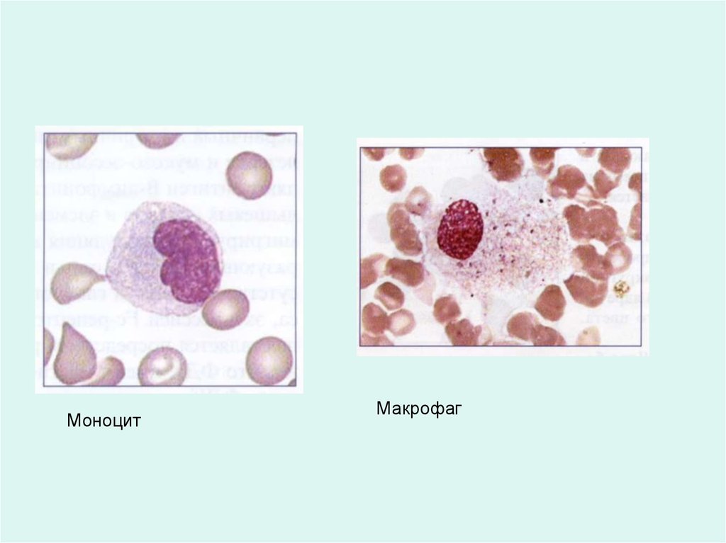 Макрофаги 2 3. Моноциты и макрофаги. Макрофаги под микроскопом. Моноциты гемопоэз. Макрофаги из моноцитов.