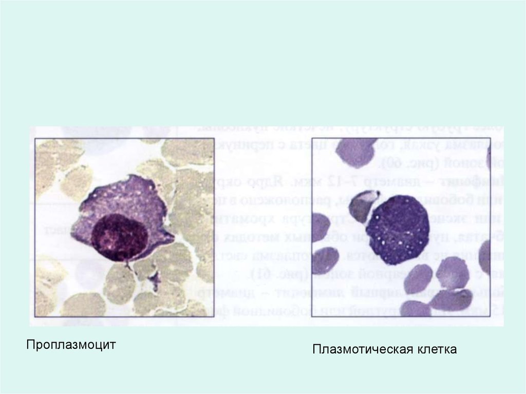 Плазмоциты. Проплазмоцит. Плазматические клетки проплазмоциты. Рисунок проплазмоцит. Проплазмоциты в крови.
