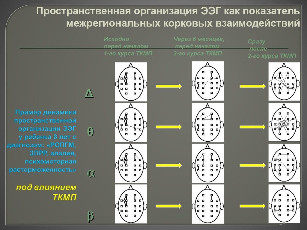 Пространственная организация. Организованная ЭЭГ. РОПГМ диагноз. Алалия на ЭЭГ. Моторная алалия у детей ЭЭГ норма.