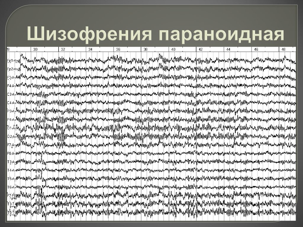 Параноидная шизофрения. Параноидальная шизофрения. Парамедиальная шизофрения. Параноидная шизофрения рисунки.