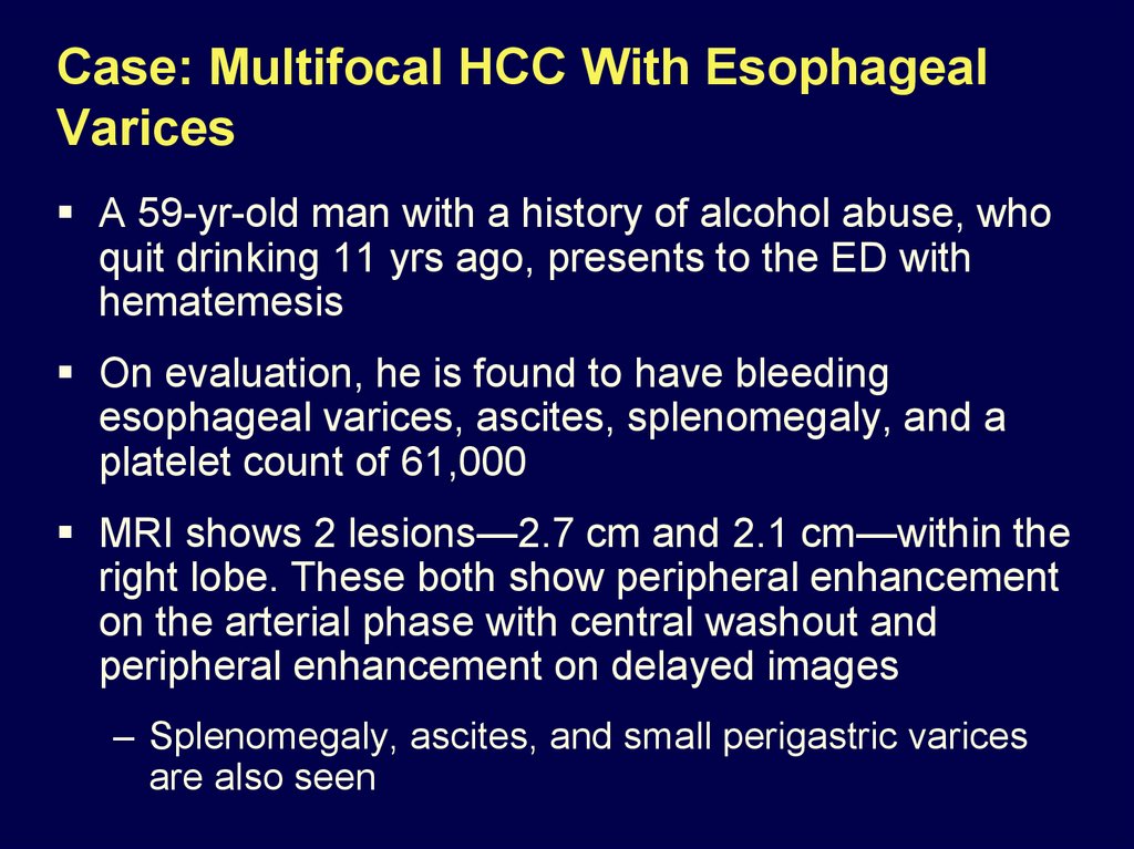 Case: Multifocal HCC With Esophageal Varices