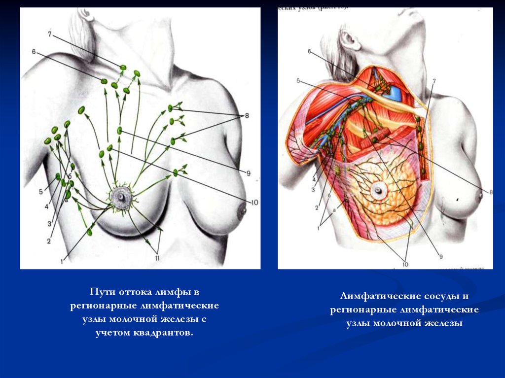 Схема лимфооттока от молочной железы