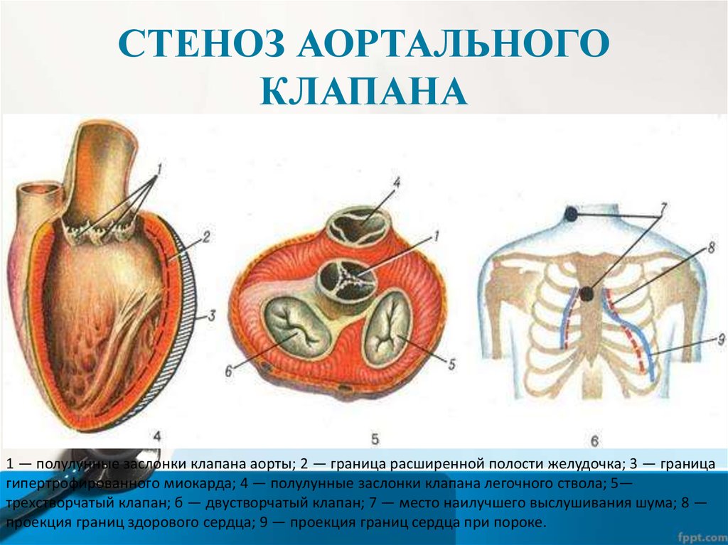 Рисунок клапанный аппарат сердца