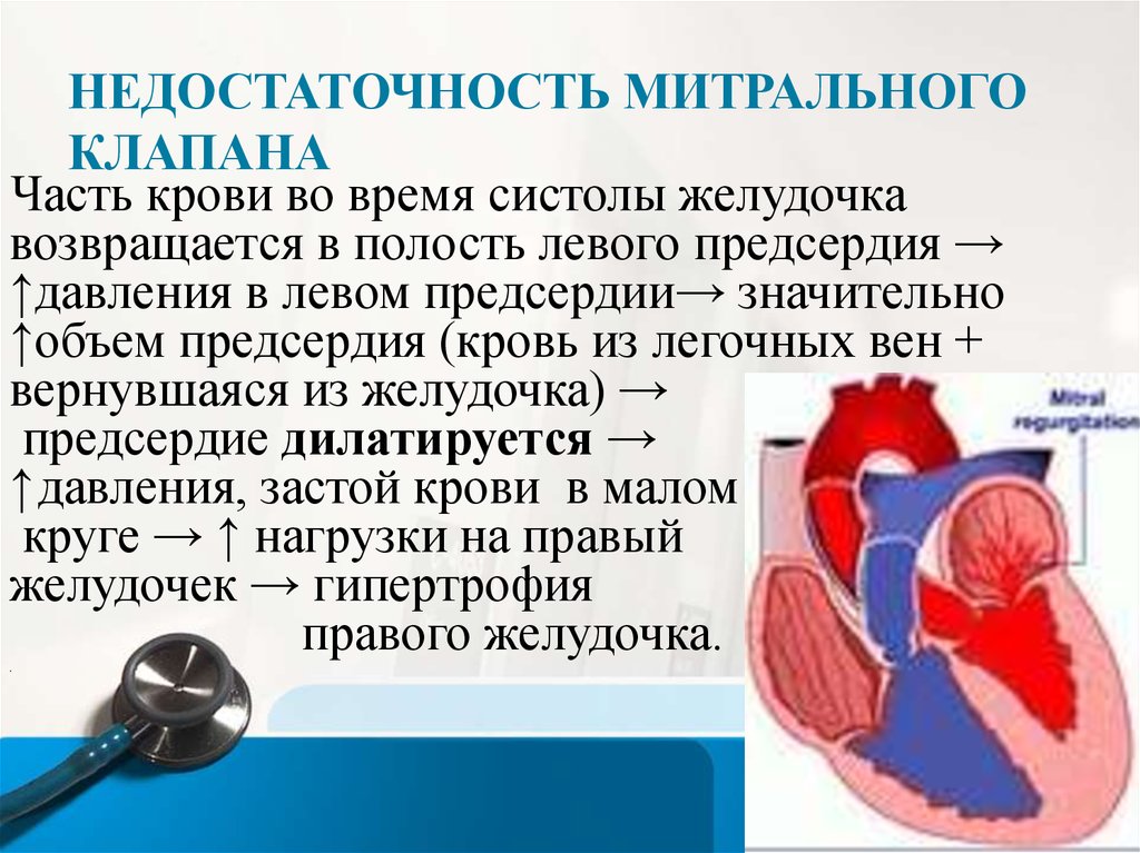 Сочетанный порок митрального клапана