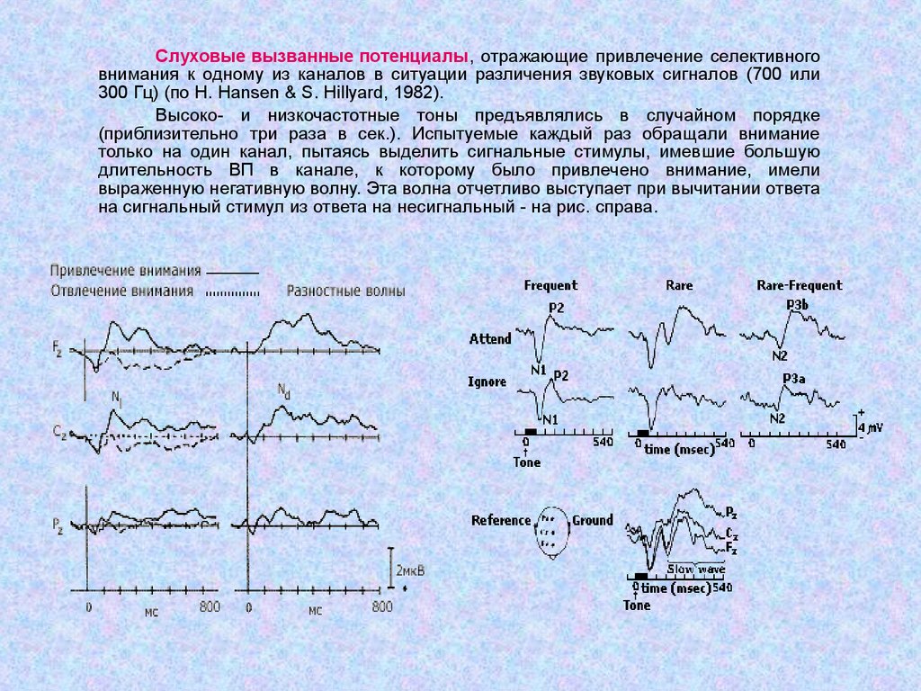 Регистрация слуховых вызванных потенциалов. Слуховые вызванные потенциалы. Длиннолатентные слуховые вызванные потенциалы. Метод вызванных потенциалов. Вызванный потенциал ЭЭГ.