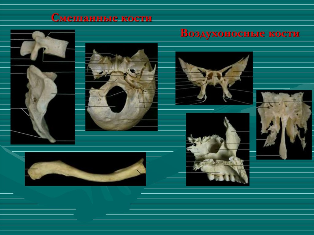 Смешанные кости. Классификация костей воздухоносные кости. Смешанные и воздухоносные кости. Смешанная кость. Смешанные кости кости.