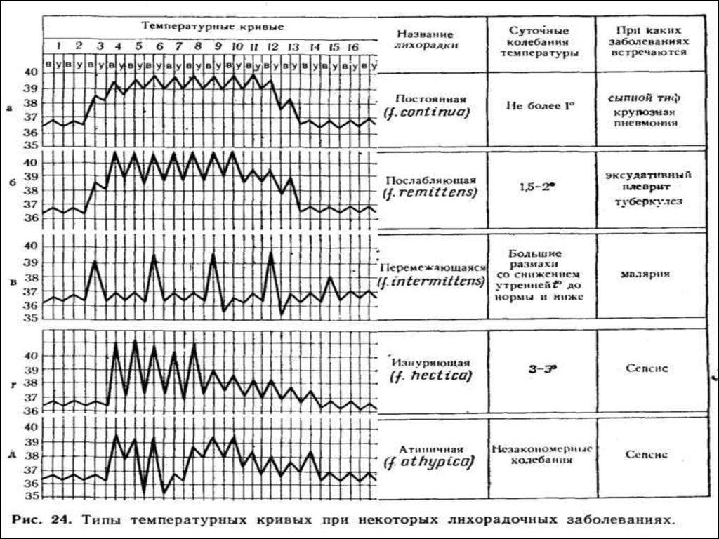 Суточные колебания температуры. Типы лихорадок графики. Типы лихорадок по длительности. Тип температурной Кривой при бруцеллезе. Температурные кривые патология.