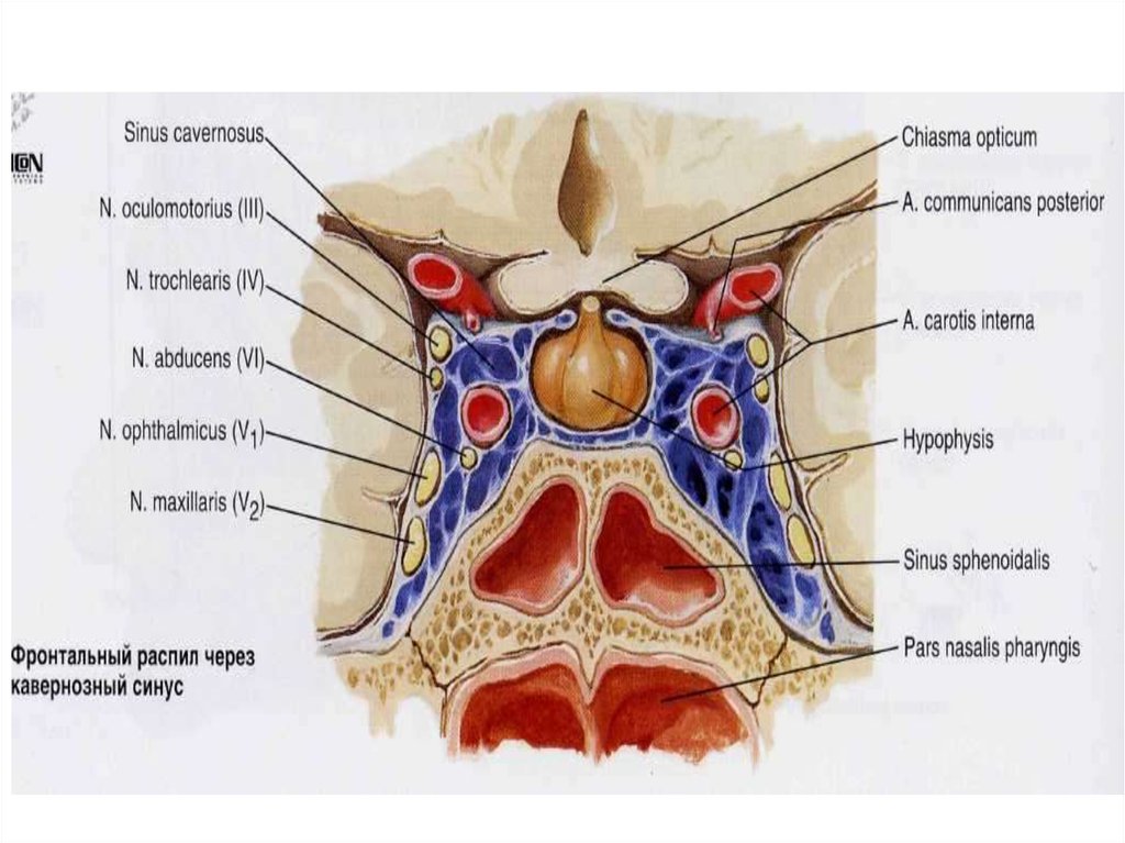 Левый синус. Топографическая анатомия кавернозного синуса. Латеральная стенка пещеристого синуса. Пещеристый и кавернозный синус. Пещеристый синус топографическая анатомия.
