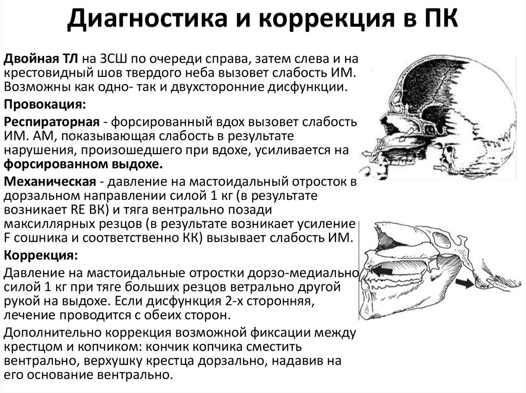 Краниальный это. Крестовидный шов твердого неба. Матсоидальный отросток. Краниальная дисфункция. Краниальный ритм.