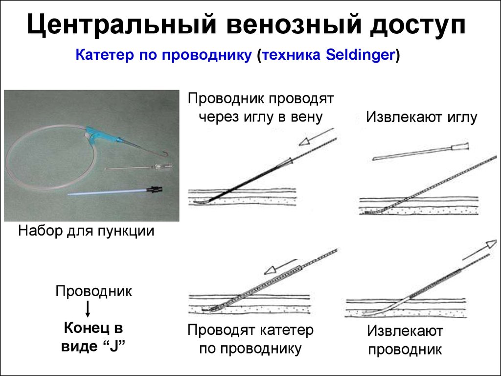 Скорость внутривенной инфузии