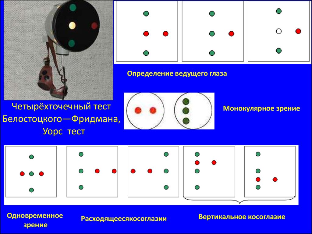 Тест ведущие. Цветотест для исследования бинокулярного зрения. Исследование бинокулярного зрения на четырехточечном аппарате. Четырехточечный тест бинокулярное зрение. Бинокулярное зрение методы исследования. Косоглазие.