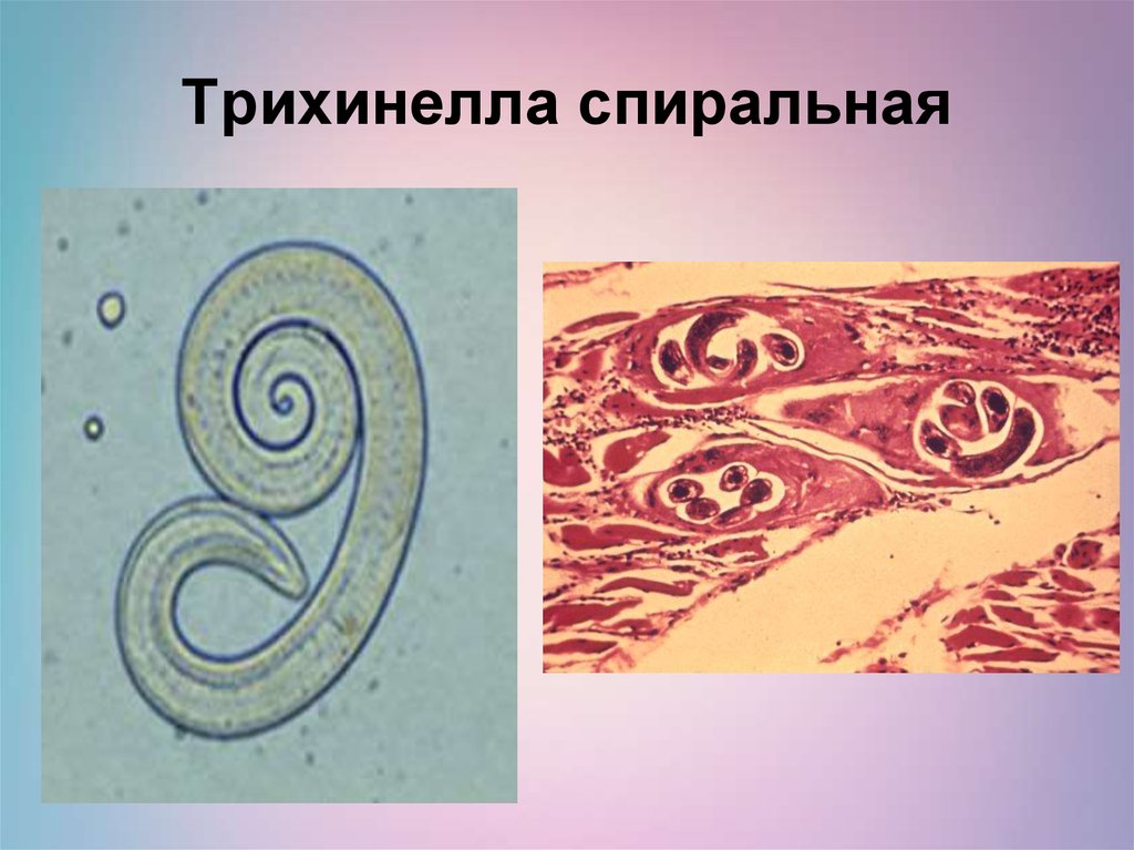 Личинки трихинеллы. Трихинелла спиральная черви. Трихинелла спиральная препарат. Трихинелла круглые черви. Заражение трихинеллы спиральной.