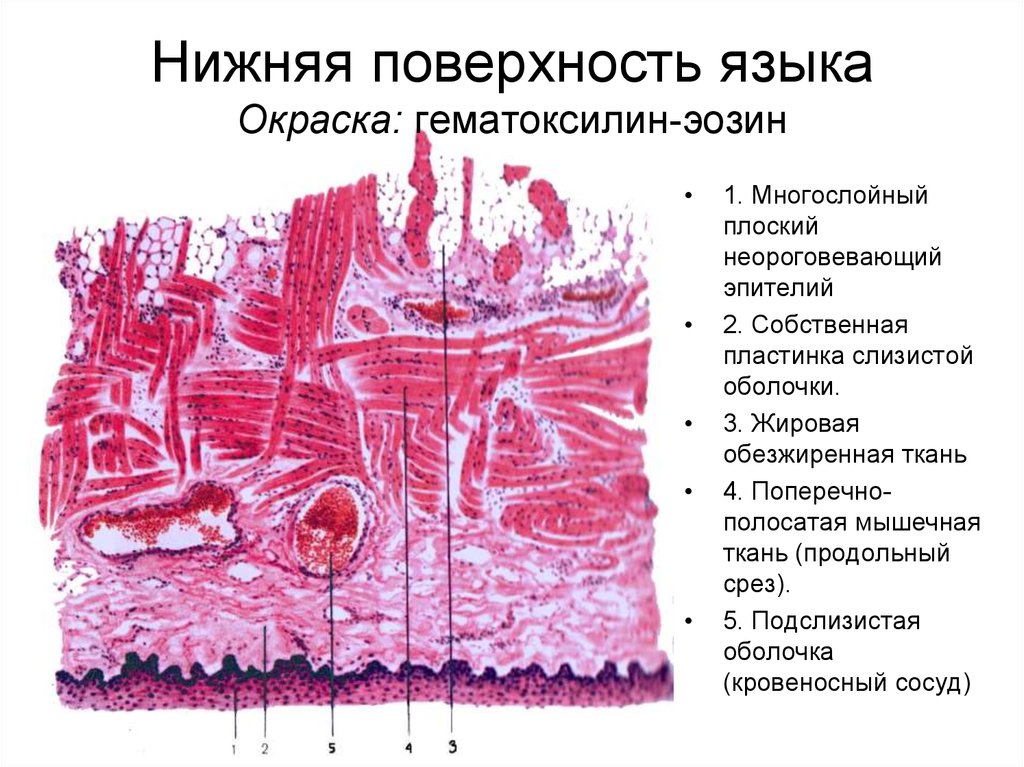 Ткань слизистой оболочки. Нитевидные сосочки эпителий. Нитевидные сосочки гистология препарат. Нижняя поверхность языка гистология препарат. Сосочки языка препарат гистология.