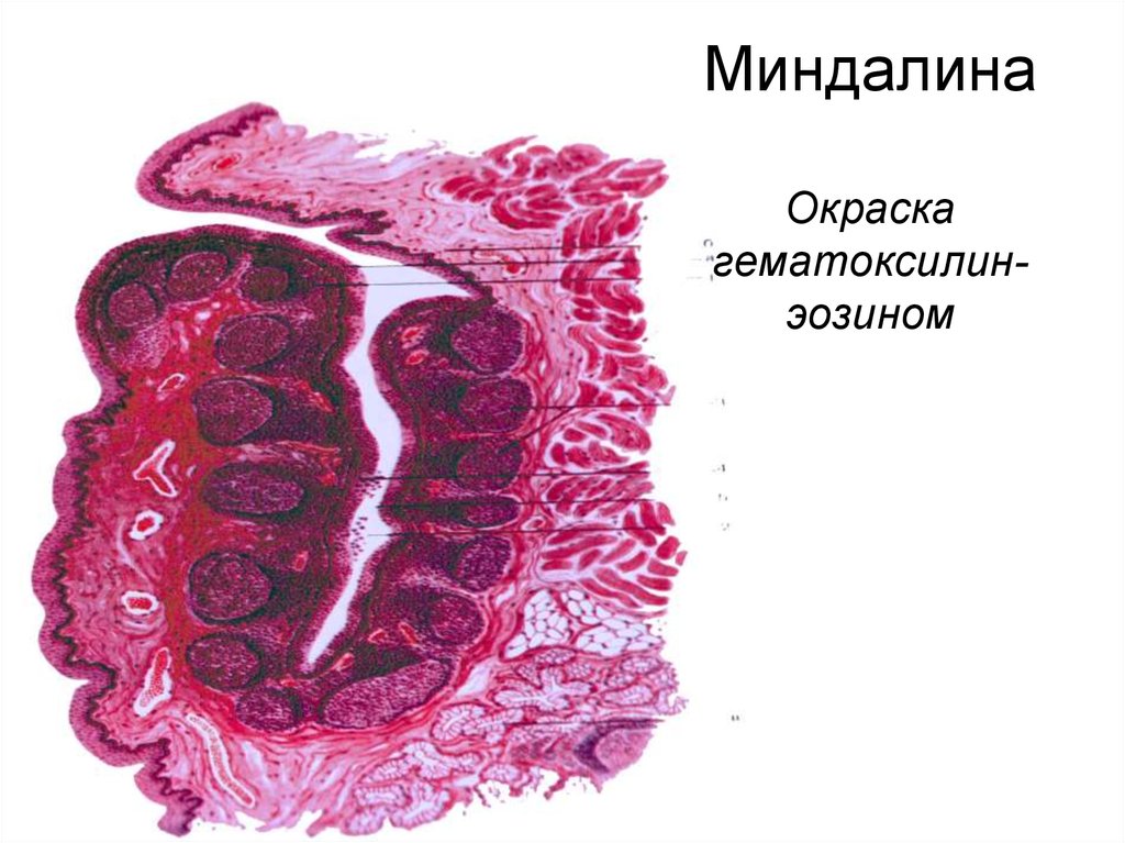 Миндалина гистология рисунок