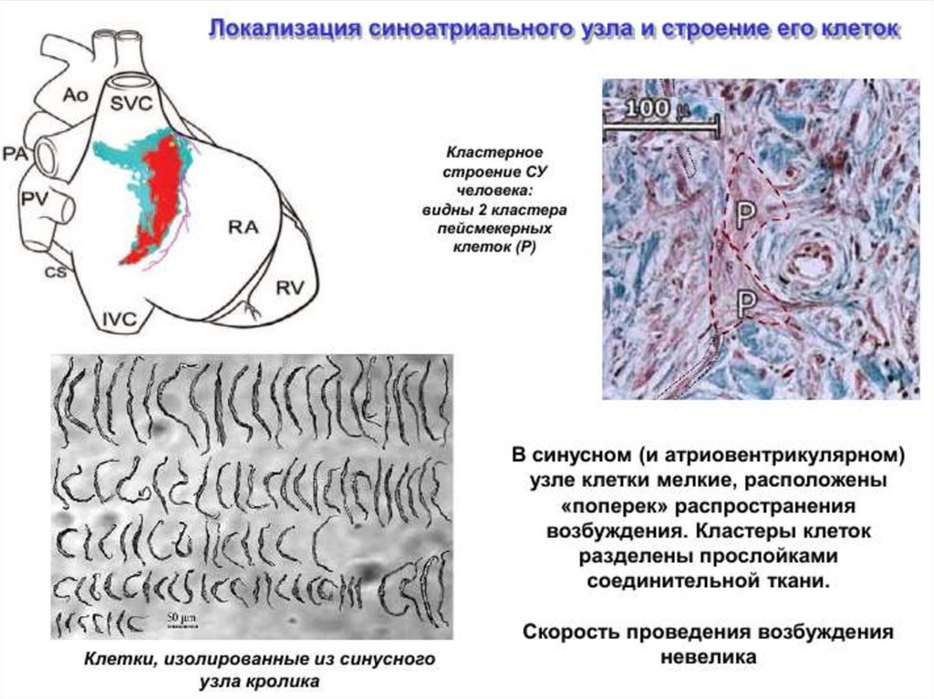 Узелки клеток. Гистологическое строение синоатриального узла. Локализация синоатриального узла:. Кластерный принцип строения синоатриального узла физиология. Синусовый узел гистология.