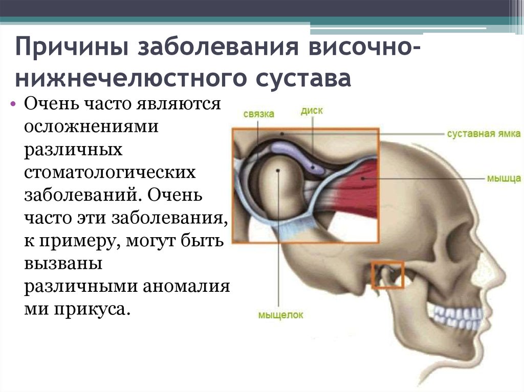 Мыщелок челюсти. Патология височно-нижнечелюстного сустава. Блоковидный сустав ВНЧС. Суставные симптомы при заболеваниях ВНЧС.