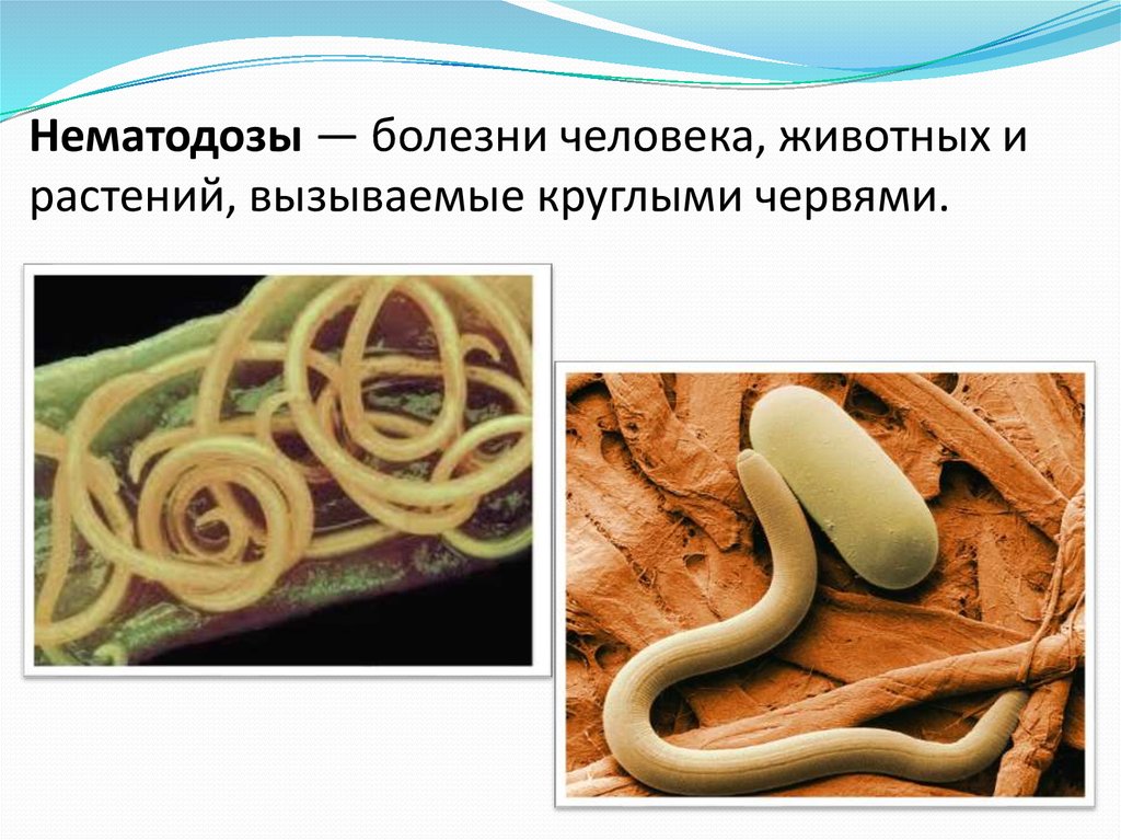 Нематодозы — болезни человека, животных и растений, вызываемые круглыми червями.