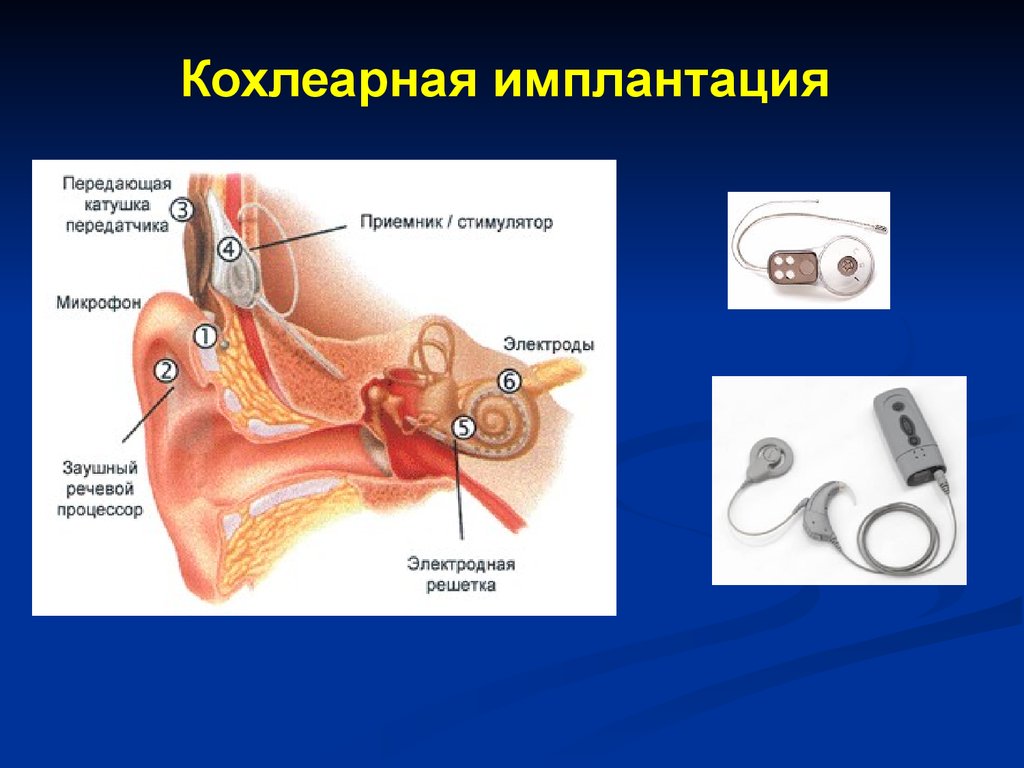 Слуховой анализатор физиология презентация