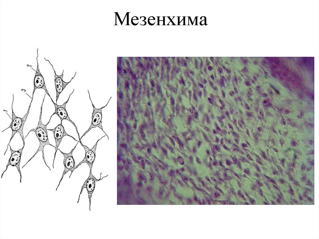 Мезенхима. Мезенхима препарат гистология. Мезенхима зародыша курицы гистология. Соединительная ткань мезенхима. Мезенхима зародыша курицы препарат гистология.