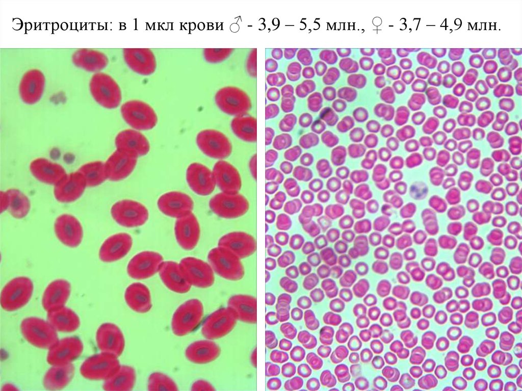 Эритроцитопения. Эритроциты. Эритроциты в млн/мкл. Мазок крови человека эритроциты. Скопление эритроцитов.