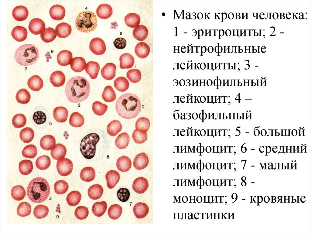 Эритроциты в простате. Лейкоциты мазок крови человека гистология. Мазок крови человека и мазок крови лягушки. Форменные элементы крови мазок микроскоп. Кровь человека эритроциты лимфоциты нейтрофилы.