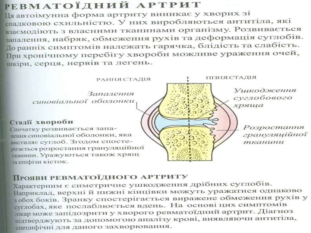 Состояние кости