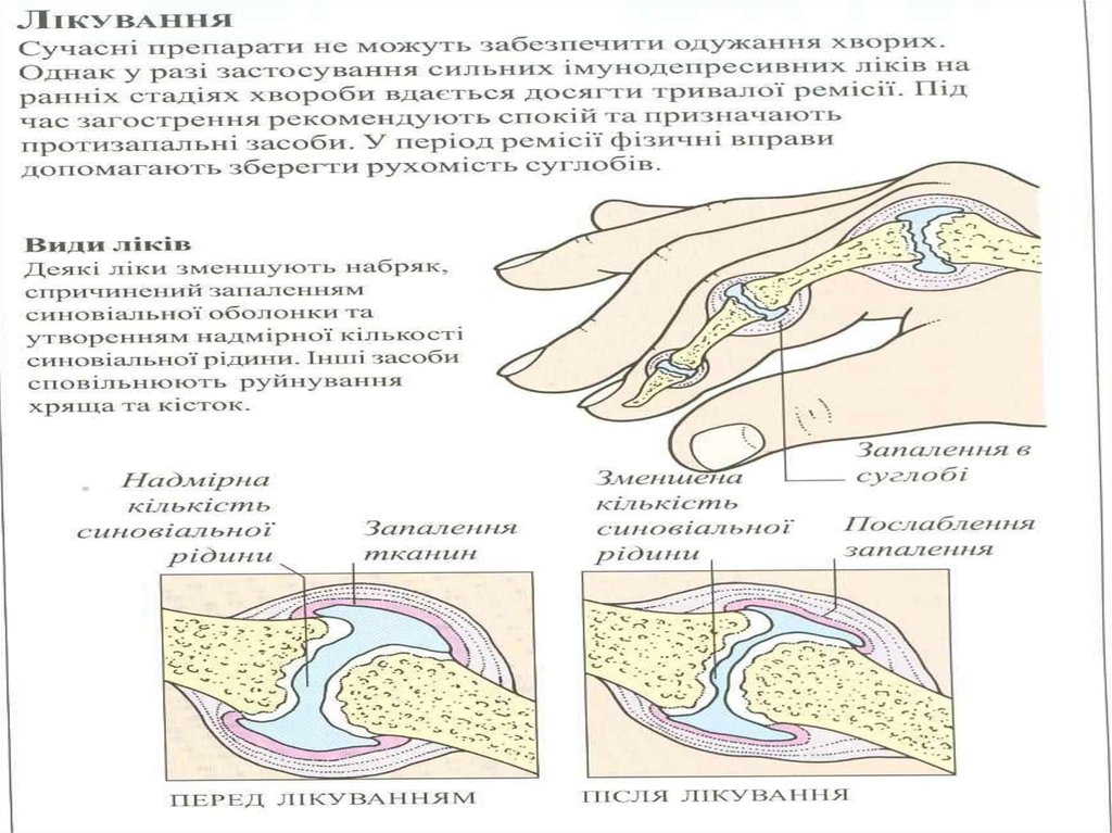 Состояние кости. Факторы влияющие на состояние костной ткани.