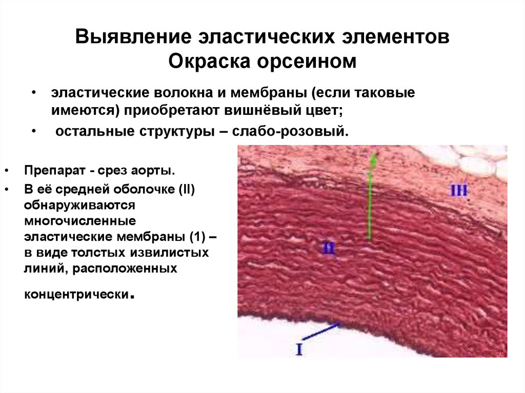 Артерии эластического типа гистология рисунок